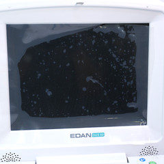 EDAN DUS 60 Digital Portable Ultrasound Diagnostic System *PARTS* T12-D8