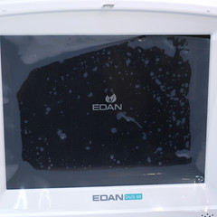 EDAN DUS 60 Digital Portable Ultrasound Diagnostic System *PARTS* T12-D8